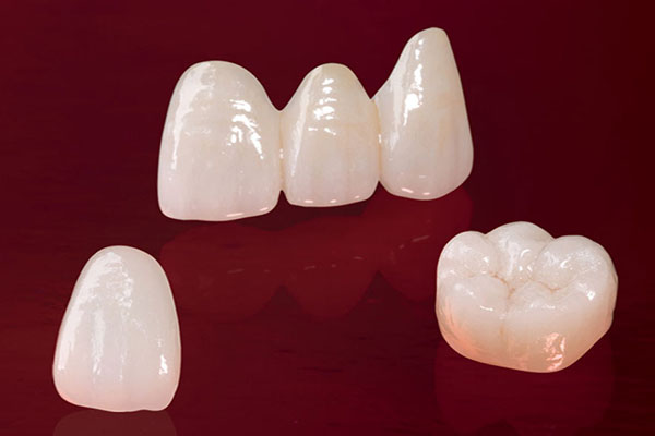 Emax diş